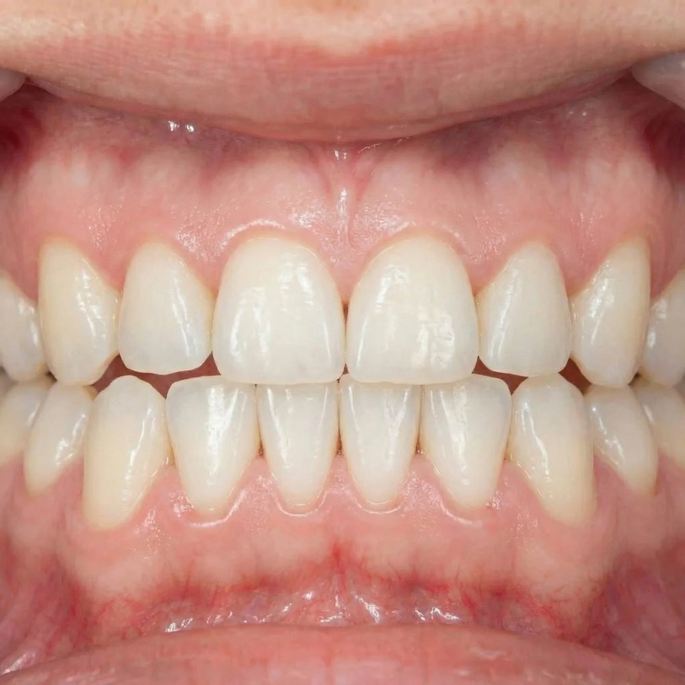 Healthier Gums — Day 30