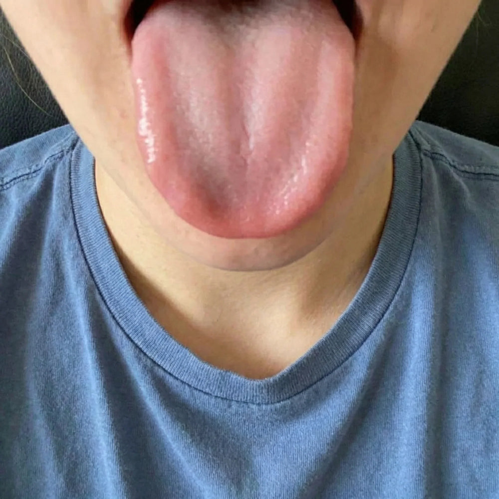 Bad breath. Gone. — Day 30
